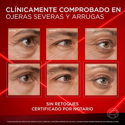 Ojos 4
