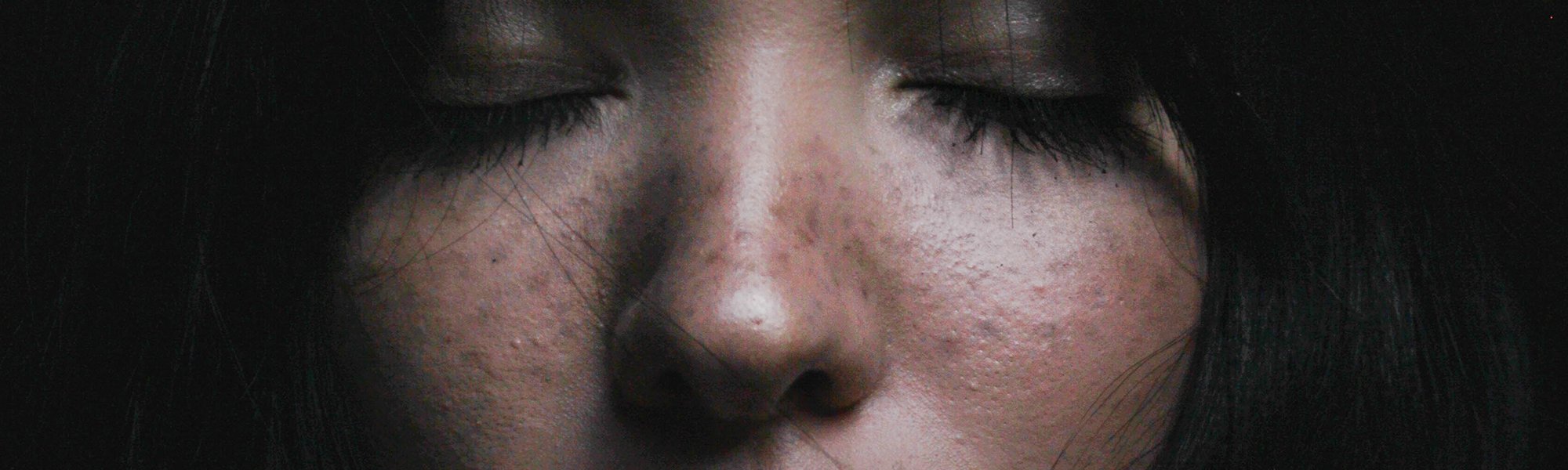 Pecas Falsas